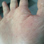 Skin Relief Hand Cream