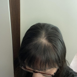 Anti Hair Loss Serum Quinine & Edelweiss